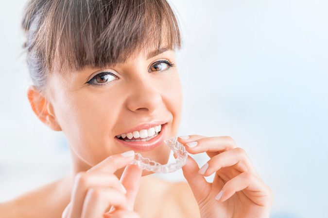 allineatori-trasparenti