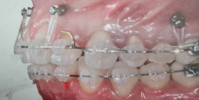 cover-corso-tads-novembre-2022