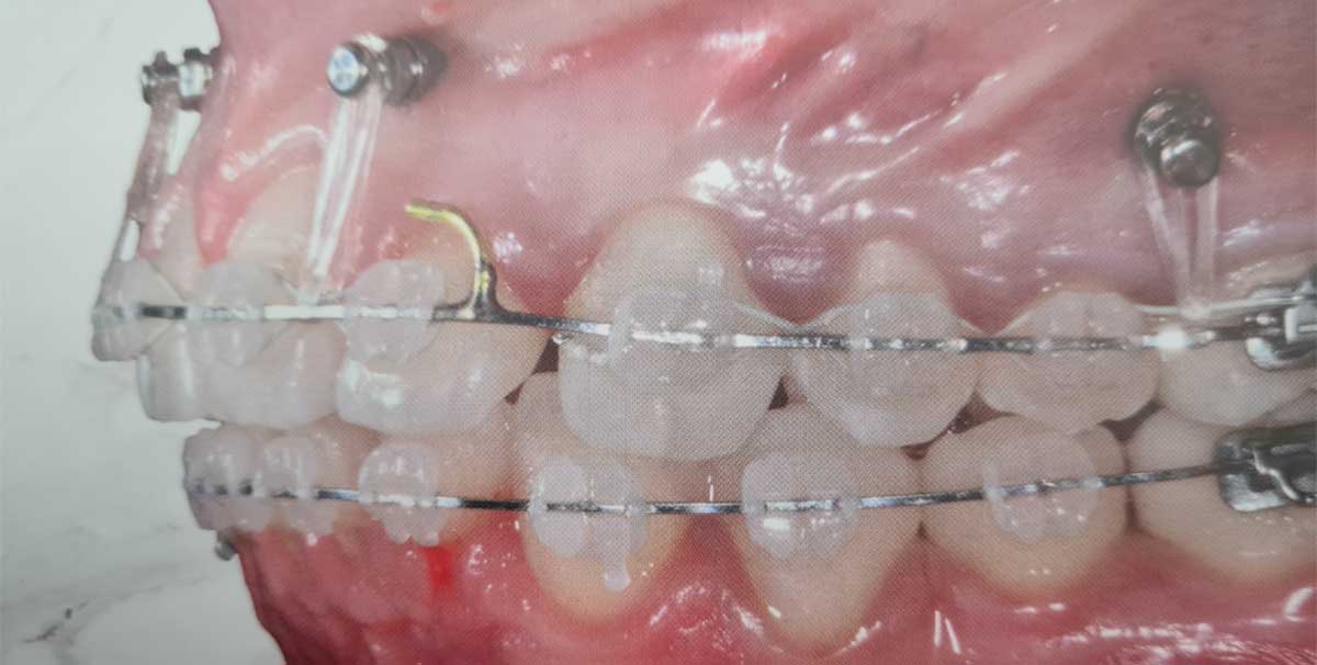 cover-corso-tads-novembre-2022